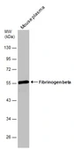 Anti-Fibrinogen beta antibody [C1C3] used in Western Blot (WB). GTX113694