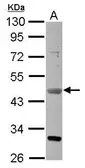Anti-VEGFD antibody used in Western Blot (WB). GTX113695
