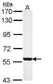 Anti-FMO3 antibody [C1C3] used in Western Blot (WB). GTX113698