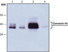 Anti-Connexin 43 antibody used in Western Blot (WB). GTX11370