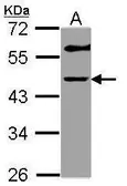 Anti-GALT antibody [N3C3] used in Western Blot (WB). GTX113702