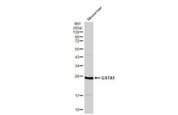 Anti-GSTA1 antibody used in Western Blot (WB). GTX113722
