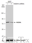 Anti-HADHA antibody [N2C1], Internal used in Western Blot (WB). GTX113727
