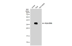 Anti-HLA-DRA antibody [N2C3] used in Western Blot (WB). GTX113732