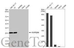 Anti-15-PGDH antibody used in Western Blot (WB). GTX113740