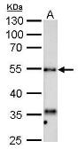 Anti-HYAL1 antibody used in Western Blot (WB). GTX113747