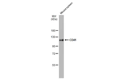 Anti-CD41 antibody [N2C1], Internal used in Western Blot (WB). GTX113758