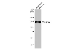 Anti-KIF5A antibody [N3C2], Internal used in Western Blot (WB). GTX113761