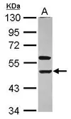Anti-KIR3DL1 antibody [N1C2] used in Western Blot (WB). GTX113763
