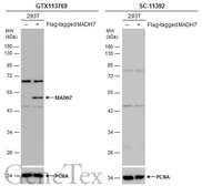 Anti-MADH7 antibody used in Western Blot (WB). GTX113769