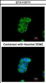 Anti-Monoamine Oxidase B antibody [N1N3] used in Immunocytochemistry/ Immunofluorescence (ICC/IF). GTX113771