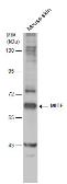 Anti-MITF antibody [N2C1], Internal used in Western Blot (WB). GTX113776