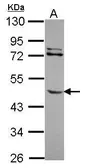 Anti-MMP8 antibody [N1C1] used in Western Blot (WB). GTX113780