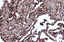 Anti-MSH3 antibody [C2C3], C-term used in IHC (Paraffin sections) (IHC-P). GTX113781
