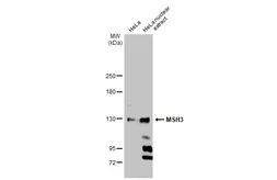 Anti-MSH3 antibody [C2C3], C-term used in Western Blot (WB). GTX113781