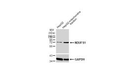 Anti-NDUFS1 antibody used in Western Blot (WB). GTX113787