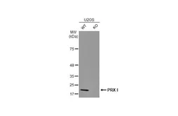 Anti-PRX I antibody [N1C3] used in Western Blot (WB). GTX113793
