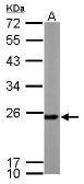 Anti-PRX I antibody [N1C3] used in Western Blot (WB). GTX113793