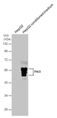 Anti-PAI3 antibody used in Western Blot (WB). GTX113795