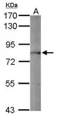 Anti-PC1/3 antibody used in Western Blot (WB). GTX113797