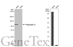 Anti-Polycystin 2 antibody used in Western Blot (WB). GTX113802