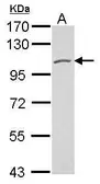 Anti-Polycystin 2 antibody used in Western Blot (WB). GTX113802