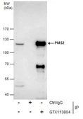Anti-PMS2 antibody [N1N3] used in Immunoprecipitation (IP). GTX113804