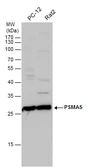 Anti-PSMA5 antibody used in Western Blot (WB). GTX113812
