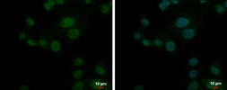 Anti-PSMD10 antibody [N1C3] used in Immunocytochemistry/ Immunofluorescence (ICC/IF). GTX113813