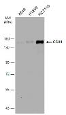 Anti-CCK4 antibody [N1N2], N-term used in Western Blot (WB). GTX113816