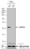 Anti-RAD23B antibody used in Western Blot (WB). GTX113820