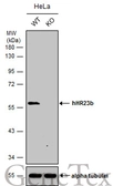 Anti-RAD23B antibody used in Western Blot (WB). GTX113820