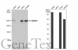 Anti-ROBO1 antibody [C2C3], C-term used in Western Blot (WB). GTX113826