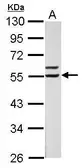 Anti-Retinoid X Receptor alpha antibody used in Western Blot (WB). GTX113828