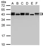 Anti-SET antibody used in Western Blot (WB). GTX113834