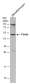 Anti-TBX5 antibody used in Western Blot (WB). GTX113849