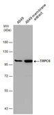 Anti-TRPC6 antibody [C2C3], C-term used in Western Blot (WB). GTX113859