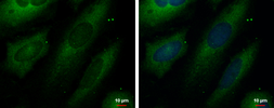 Anti-UNG antibody used in Immunocytochemistry/ Immunofluorescence (ICC/IF). GTX113860