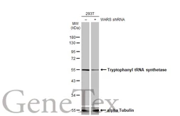 Anti-Tryptophanyl tRNA synthetase antibody used in Western Blot (WB). GTX113861