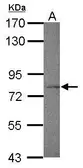 Anti-FXR1 antibody used in Western Blot (WB). GTX113867