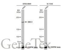 Anti-SRC3 antibody [N1N2], N-term used in Western Blot (WB). GTX113869