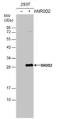 Anti-NR0B2 antibody [N2C3] used in Western Blot (WB). GTX113874