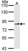 Anti-Cullin 4a antibody [N1C1] used in Western Blot (WB). GTX113876