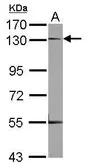 Anti-Neuropilin 1 antibody [N1N3] used in Western Blot (WB). GTX113886
