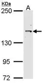 Anti-Cullin 7 antibody [C2C3], C-term used in Western Blot (WB). GTX113906
