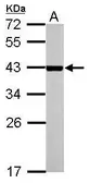 Anti-NR1I3 antibody used in Western Blot (WB). GTX113909