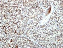 Anti-BCL2L10 antibody [N1C3] used in IHC (Paraffin sections) (IHC-P). GTX113911