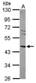 Anti-LXR alpha antibody [N1C2] used in Western Blot (WB). GTX113912
