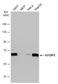 Anti-IGF2BP2 antibody used in Western Blot (WB). GTX113923