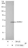 Anti-RUVBL2 antibody [N1C1] used in Immunoprecipitation (IP). GTX113926